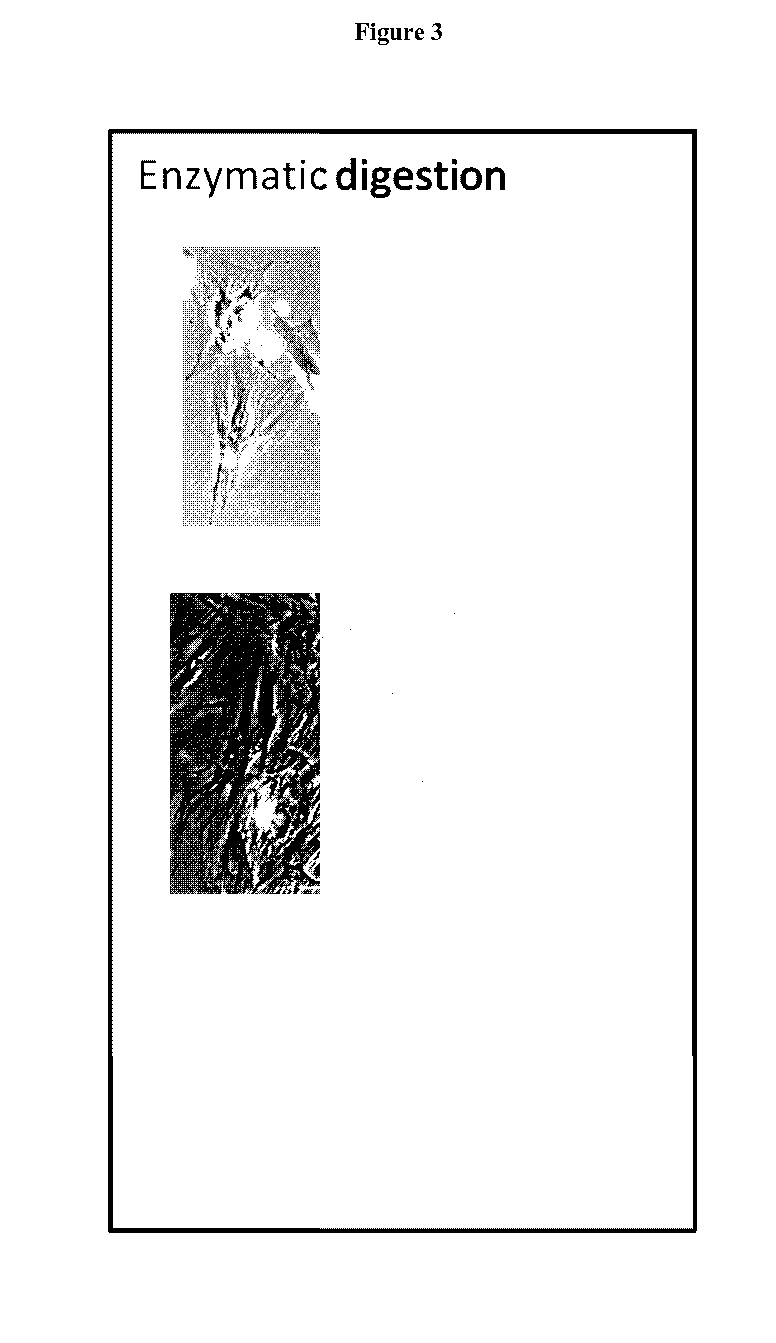 Preparation of parental cell bank from foetal tissue