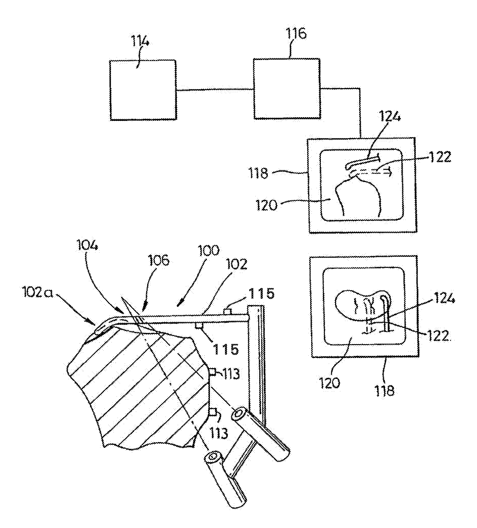 Reconstruction of Anterior Cruciate Ligaments