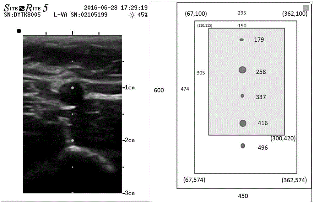 Automatic positioning method and device of indwelling needle in puncturing vein vessel