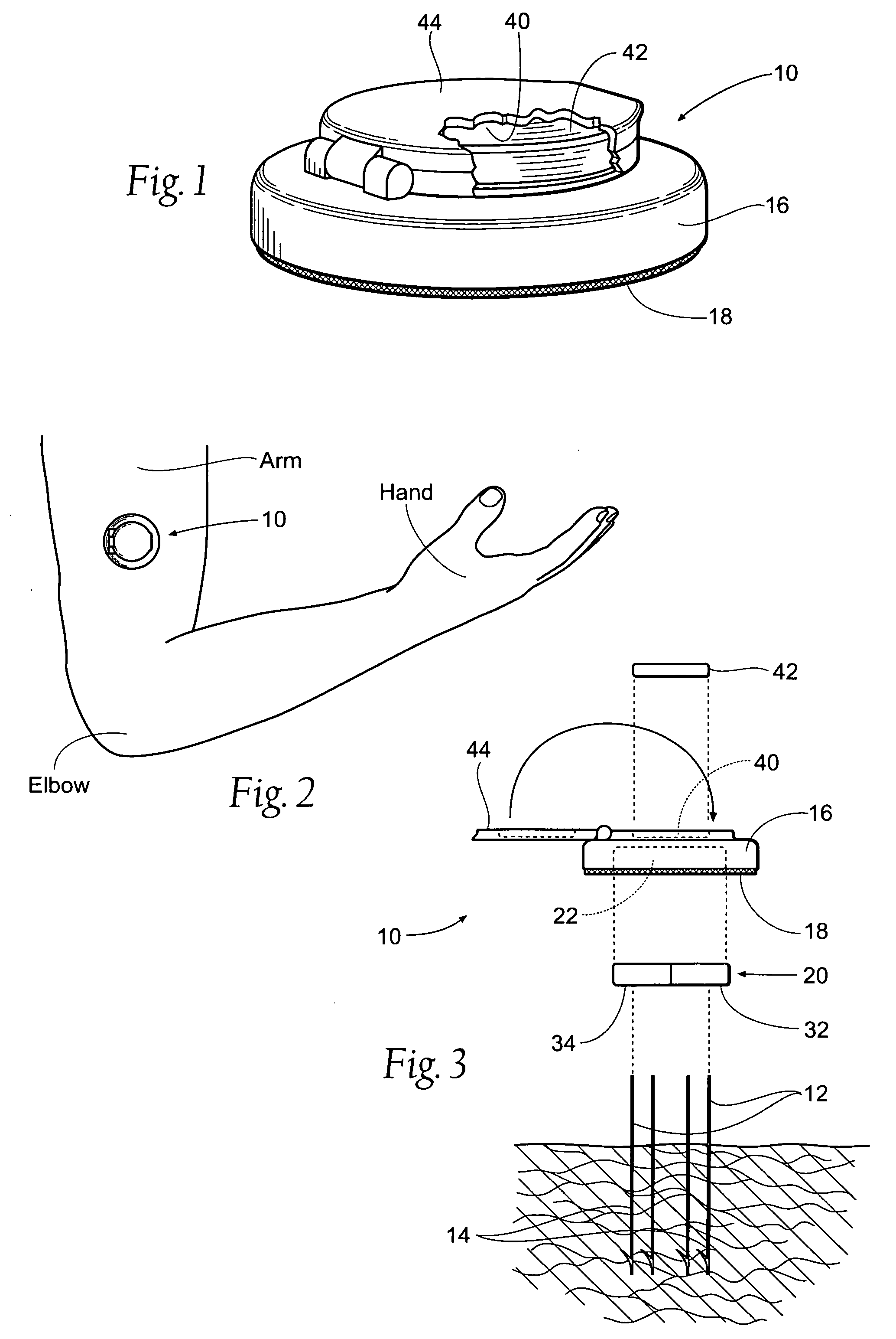 Percutaneous electrode assemblies, systems, and methods for providing highly selective functional or therapeutic neuromuscular stimulation