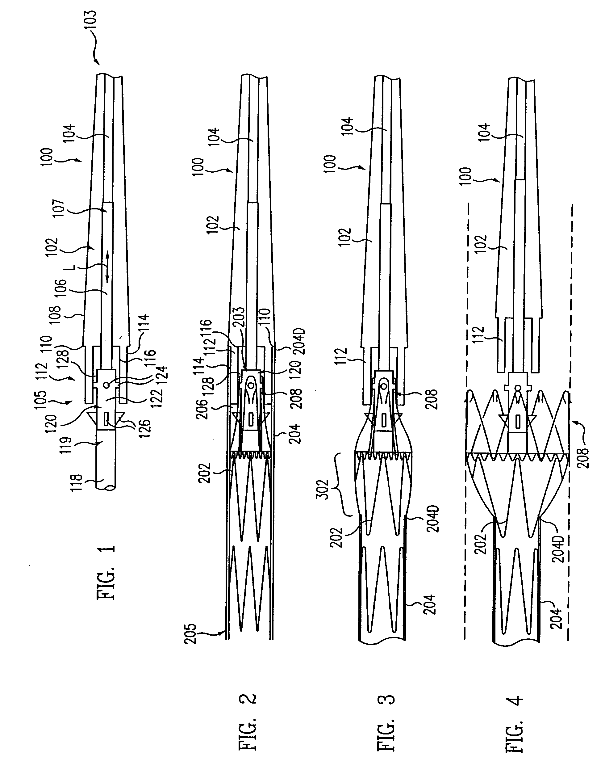 Delivery System for Stent-Graft