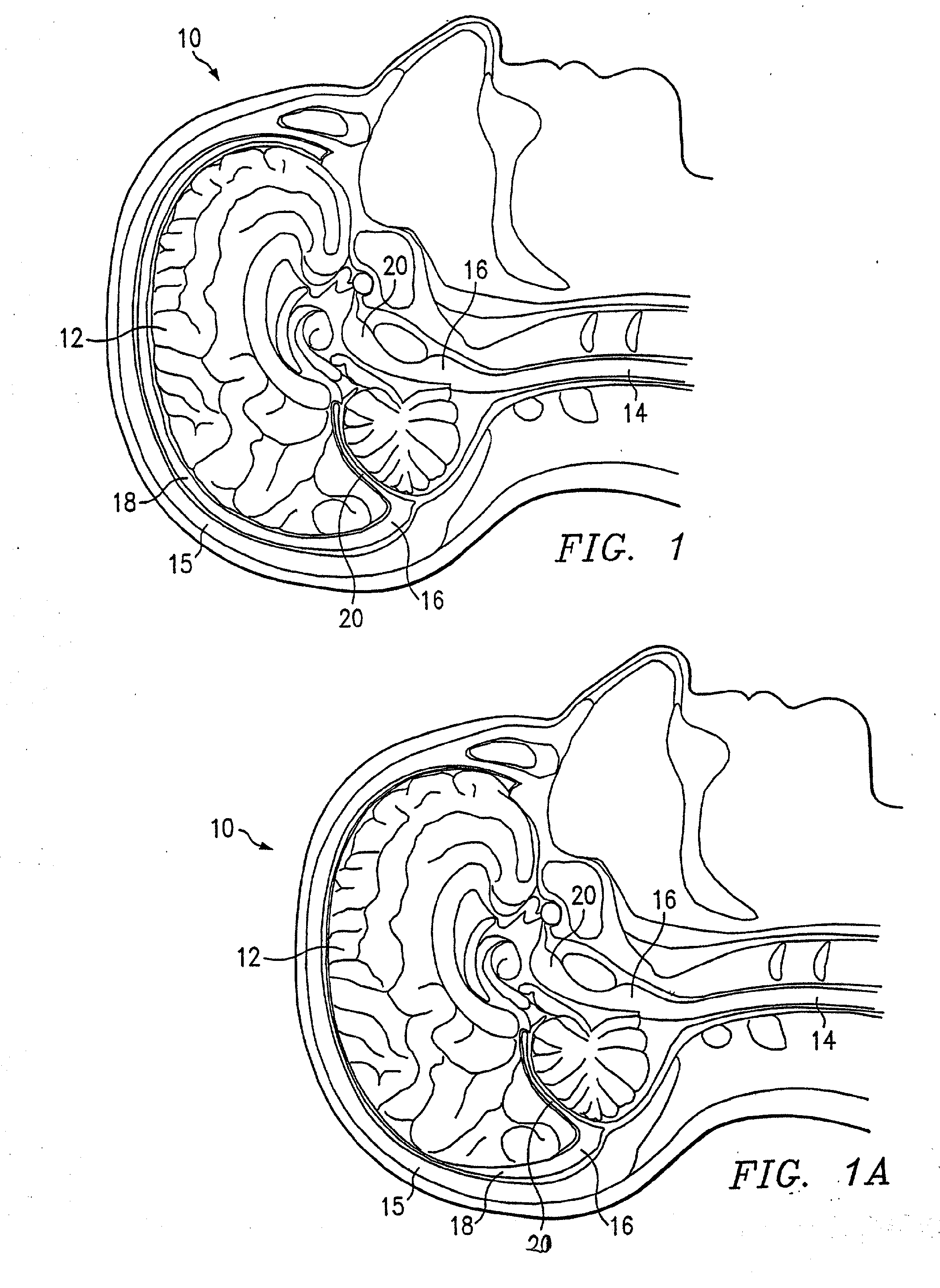 Therapeutic Cooling Devices