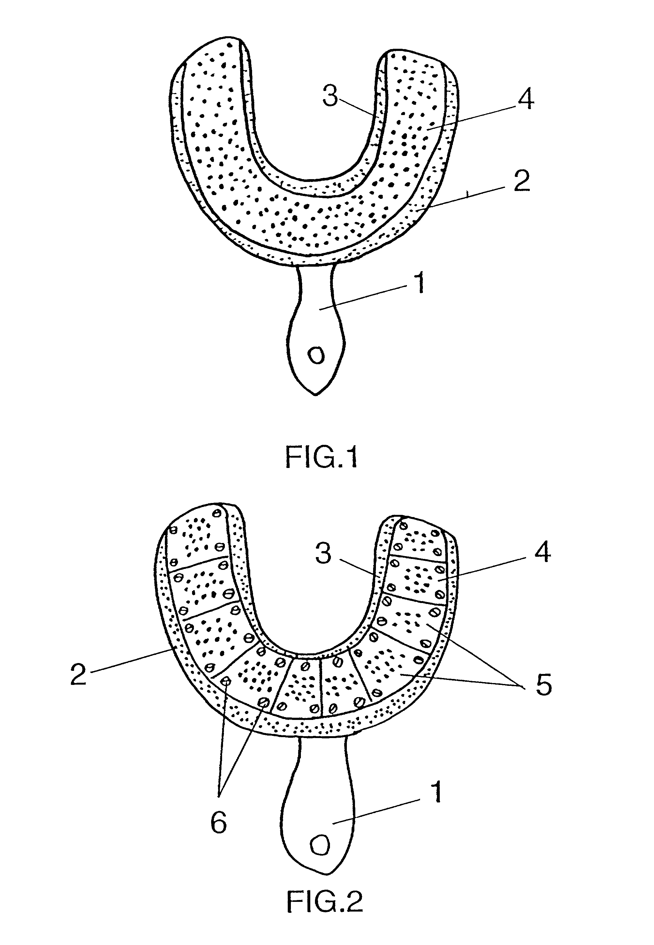 Imperssion tray device with removable segments for dental implant transfers