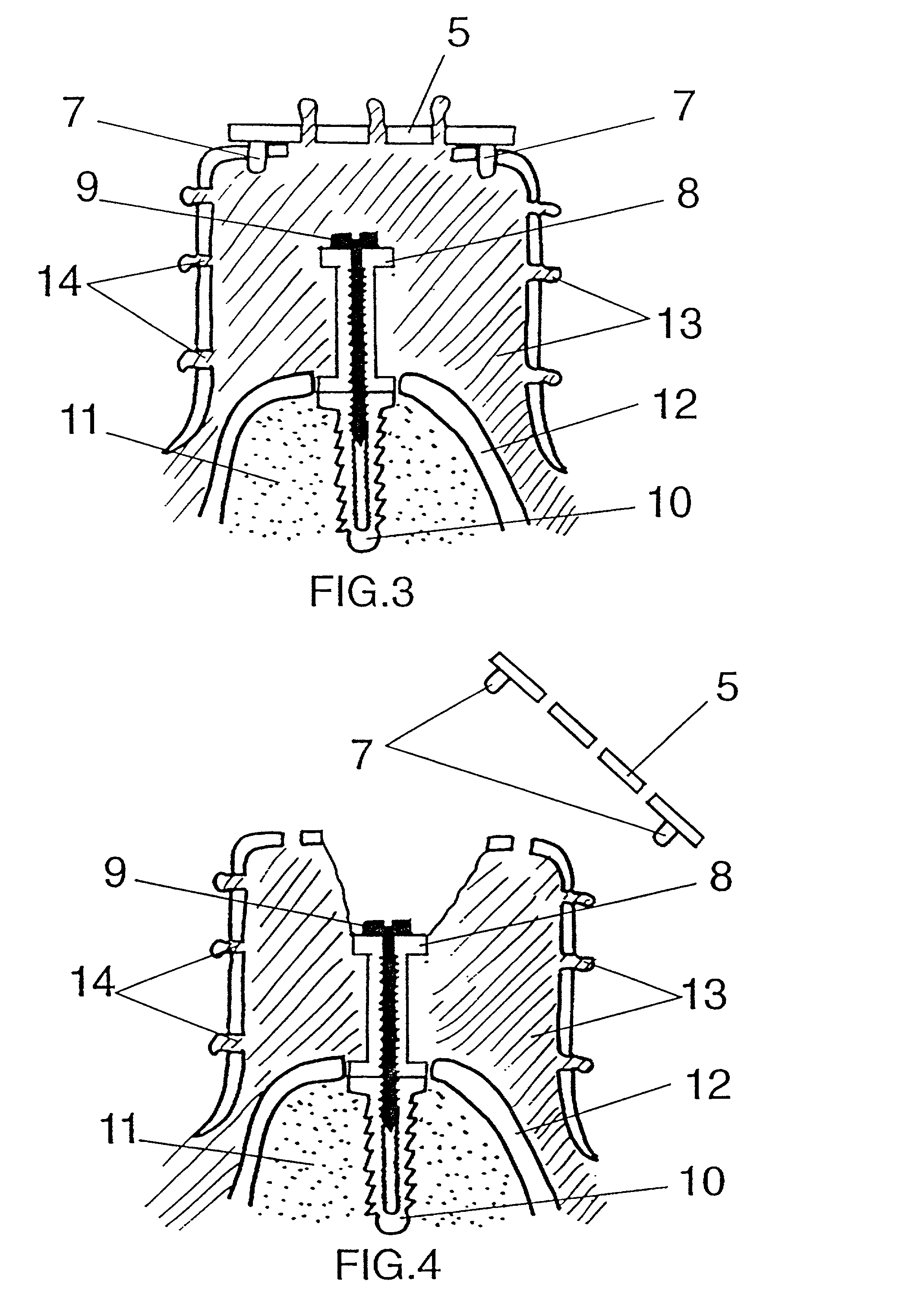 Imperssion tray device with removable segments for dental implant transfers