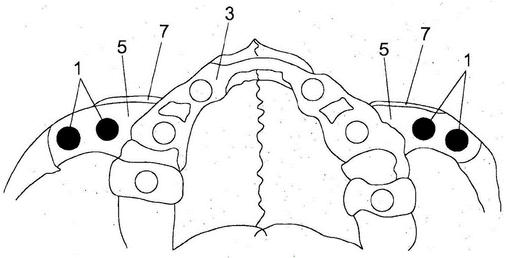 System for securing dental prosthesis