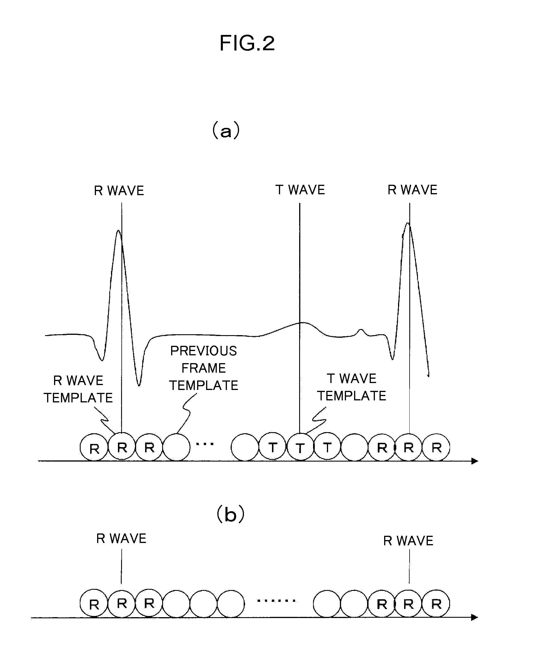 Medical image diagnostic device