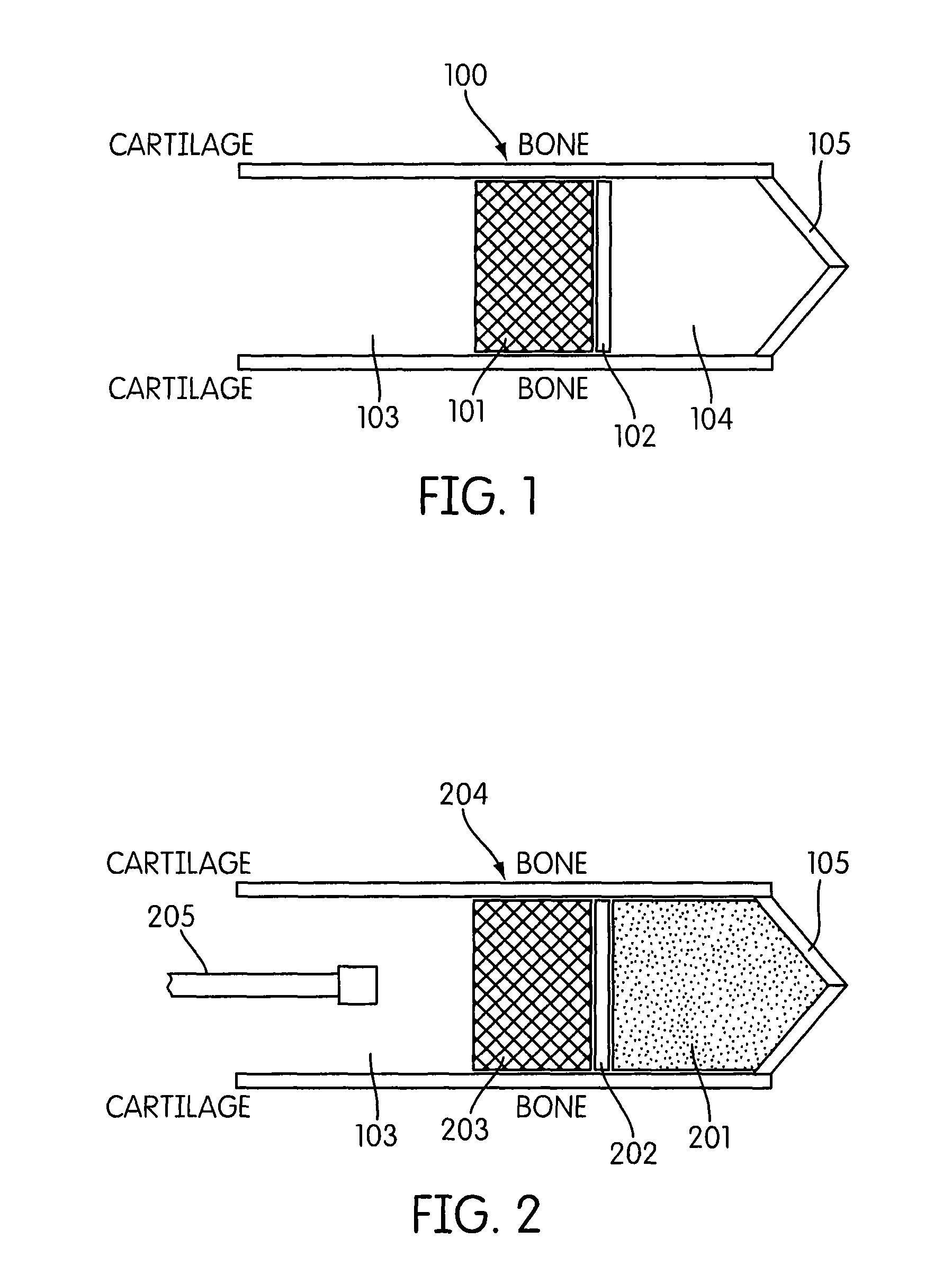 Earpiece and method for forming an earpiece