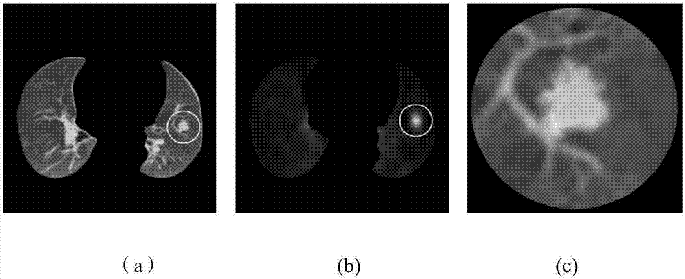 Pulmonary nodule segmentation method of LBF active contour model based on information entropy and combination vector