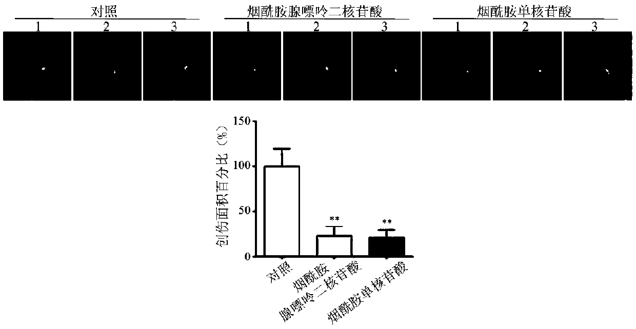 Application of nicotinamide adenine dinucleotide or precursor substance thereof in preparation of medicament for treating corneal epithelial defect