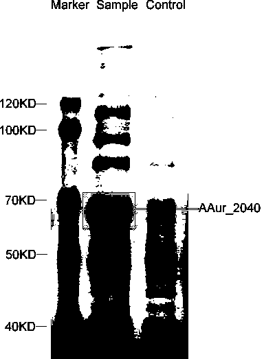 A coding gene of swainsonine degrading enzyme and its application