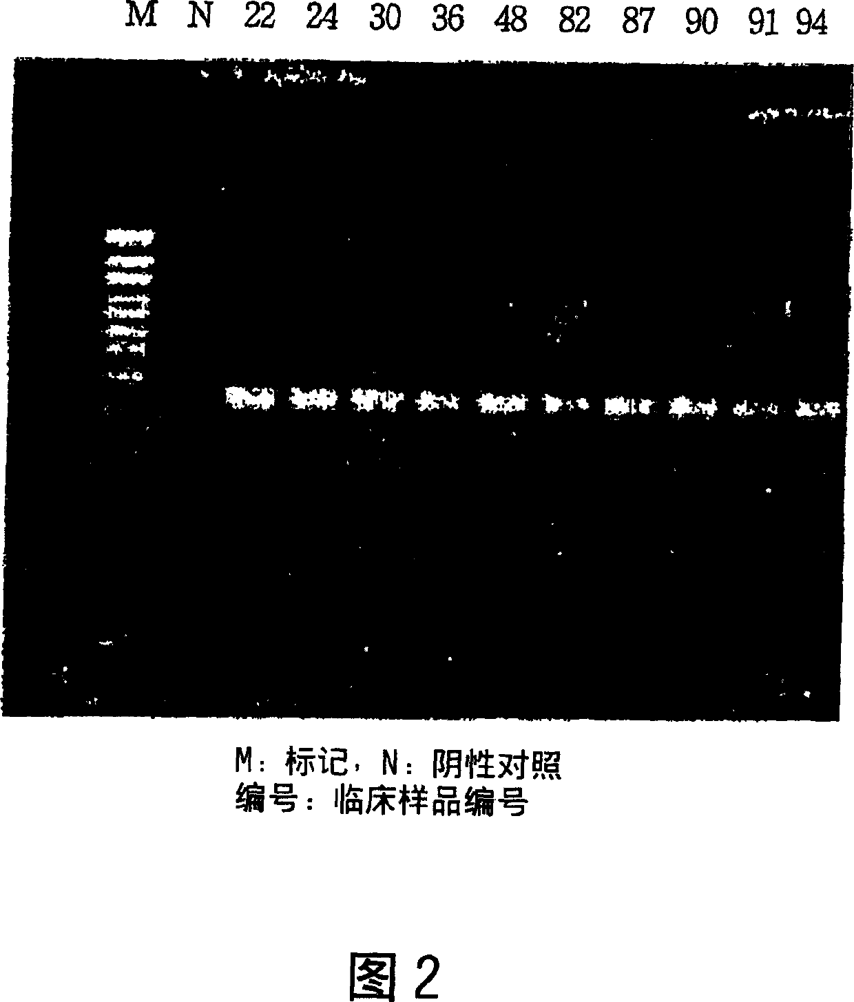 Diagnosis kit for mycobacterium species identification and drug-resistance detection and mfg. method thereof