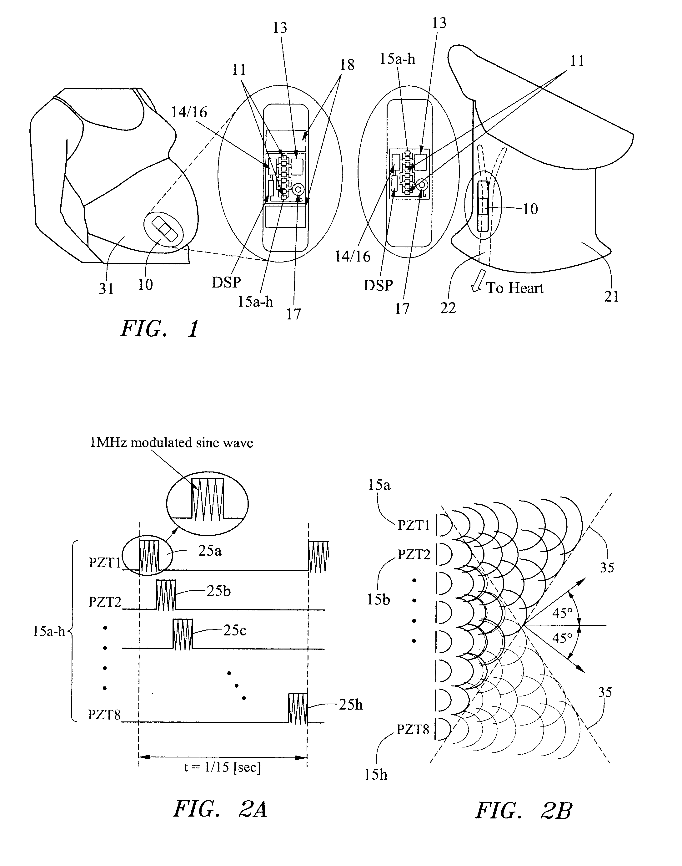 Ultrasound patch