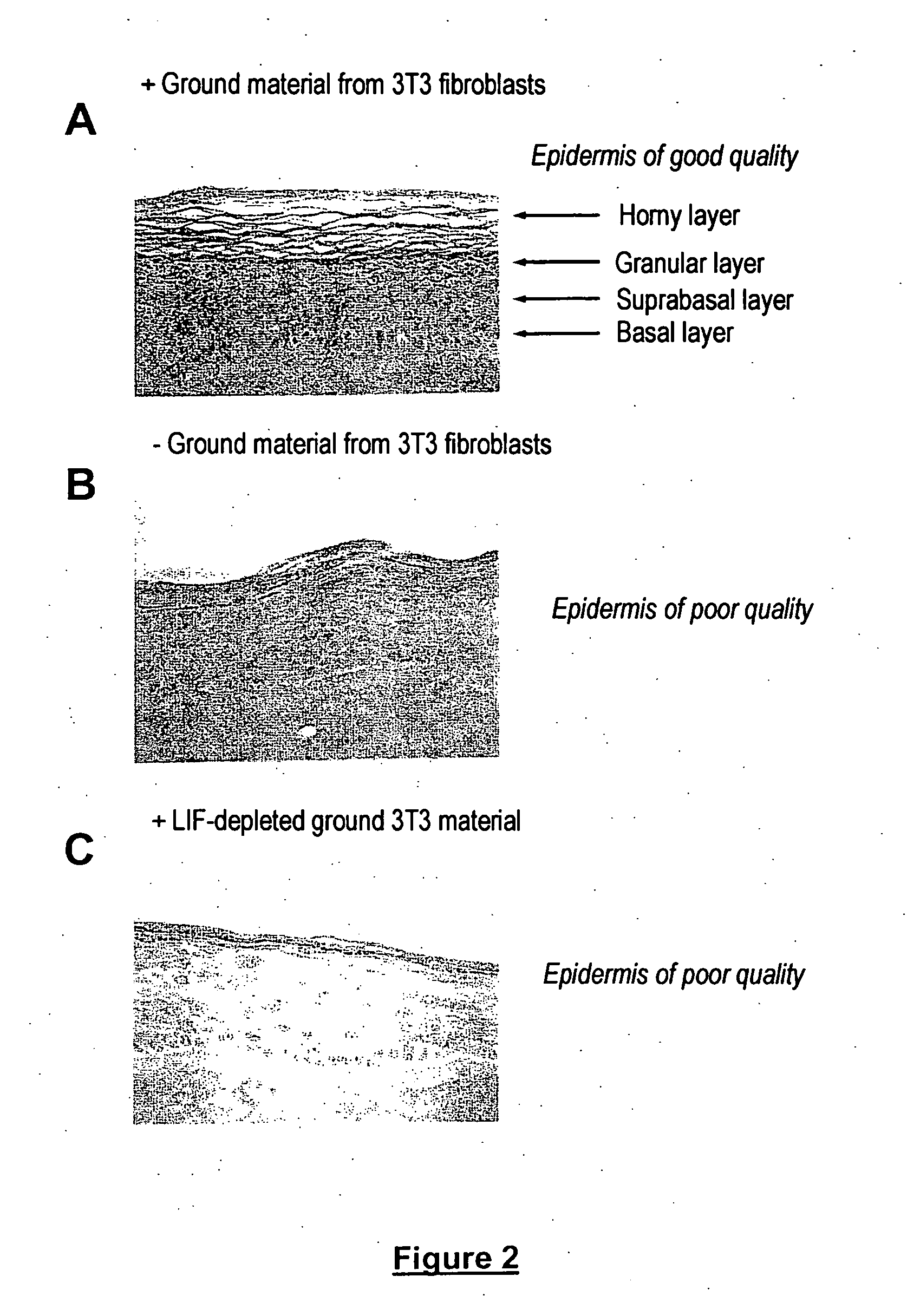 Cosmetic/dermatological applications of LIF