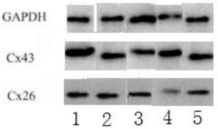 Application of Tianqingdibai Extract as Gene Therapy Sensitizer