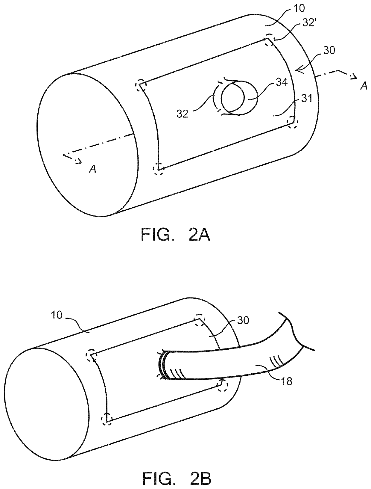 Aortic connectors and methods of use