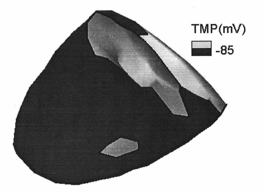 Method for detecting heart surface transmural potential distribution