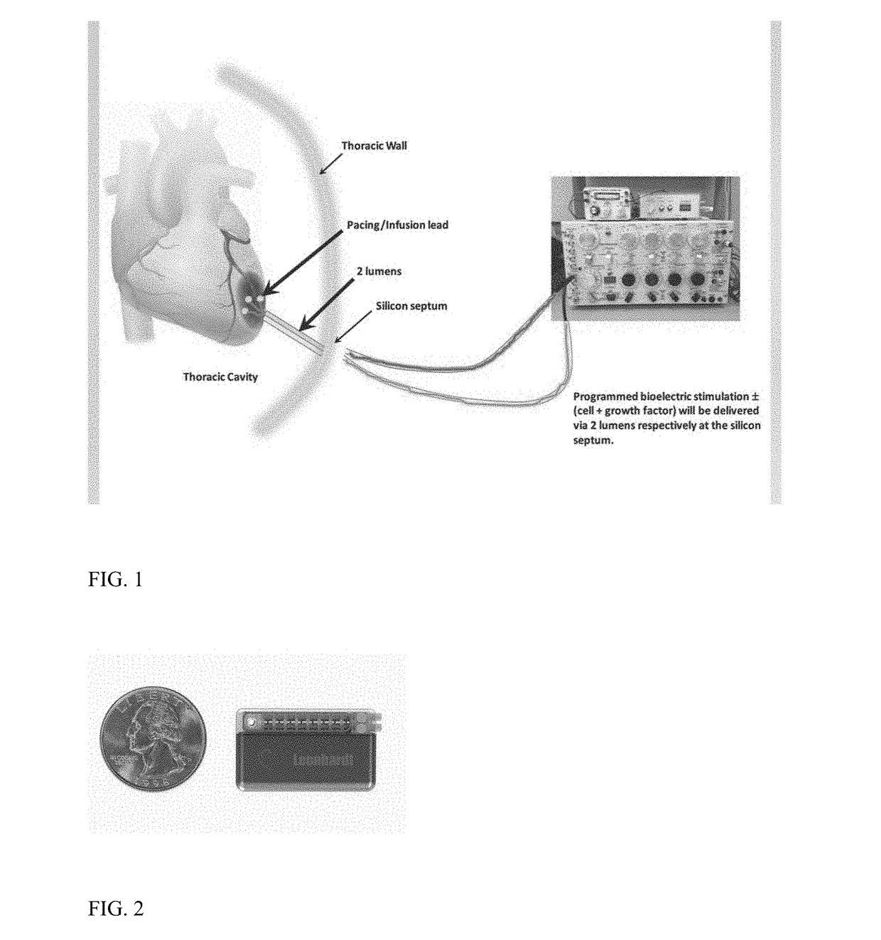 Stimulator, pump & composition