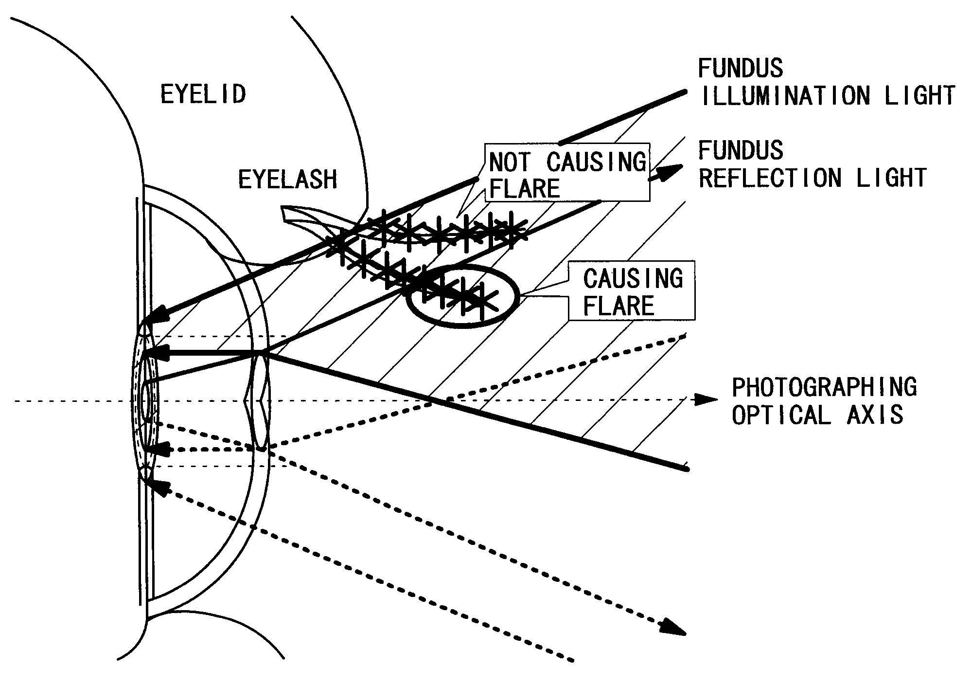 Fundus camera