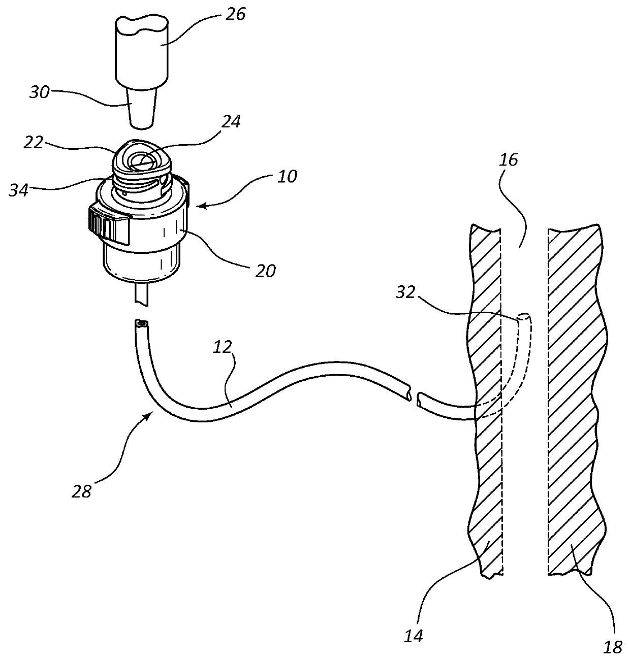 Retention feature for soft interface connection