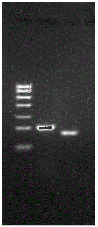 In-vitro molecule detection method of EC-SOD (extra-cellular super oxide dismutase) and primers