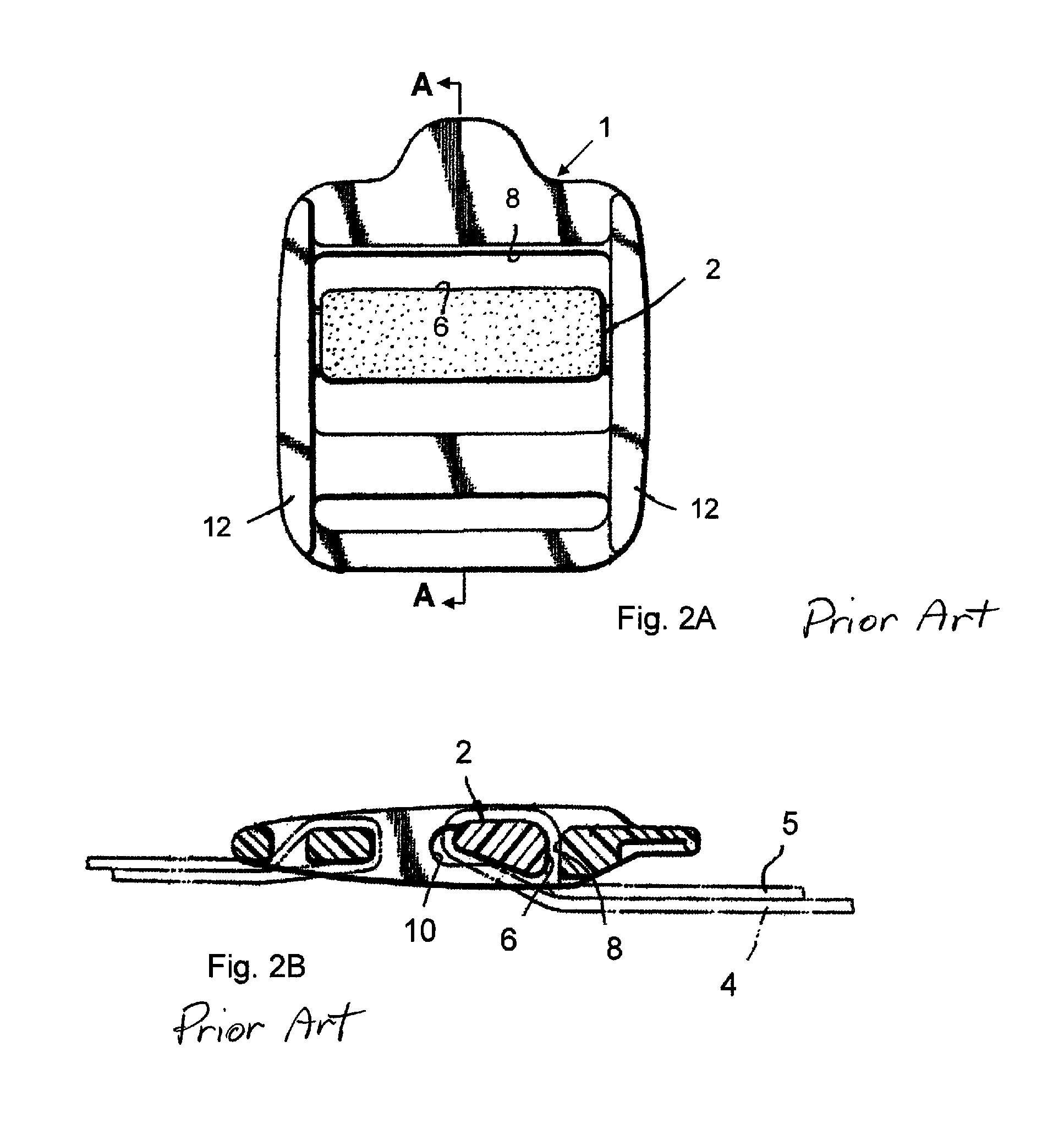 Flat suture banding system and methods