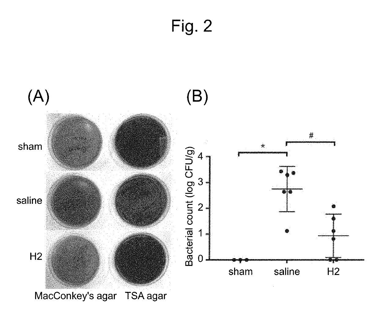 Composition for suppressing or preventing abnormality in intestinal environment