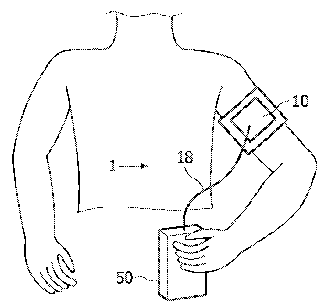 Measurement and stimulation of muscle tissue