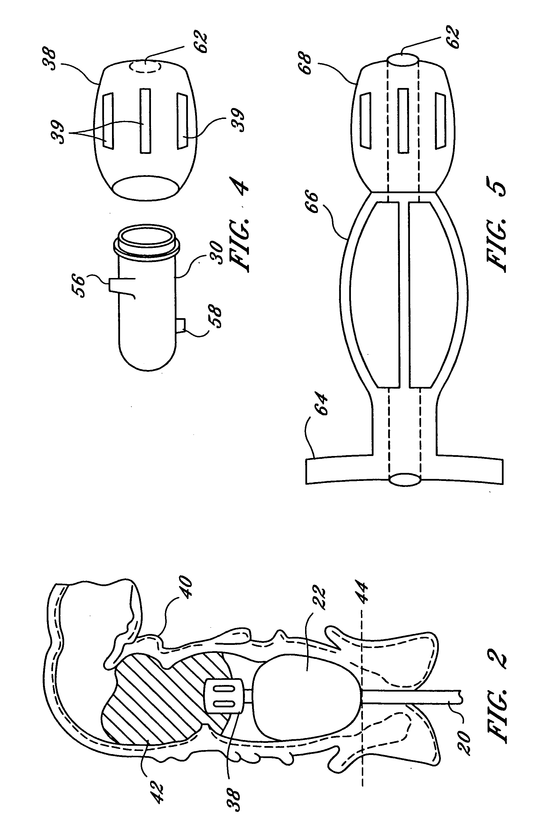 Fecal incontinence management device