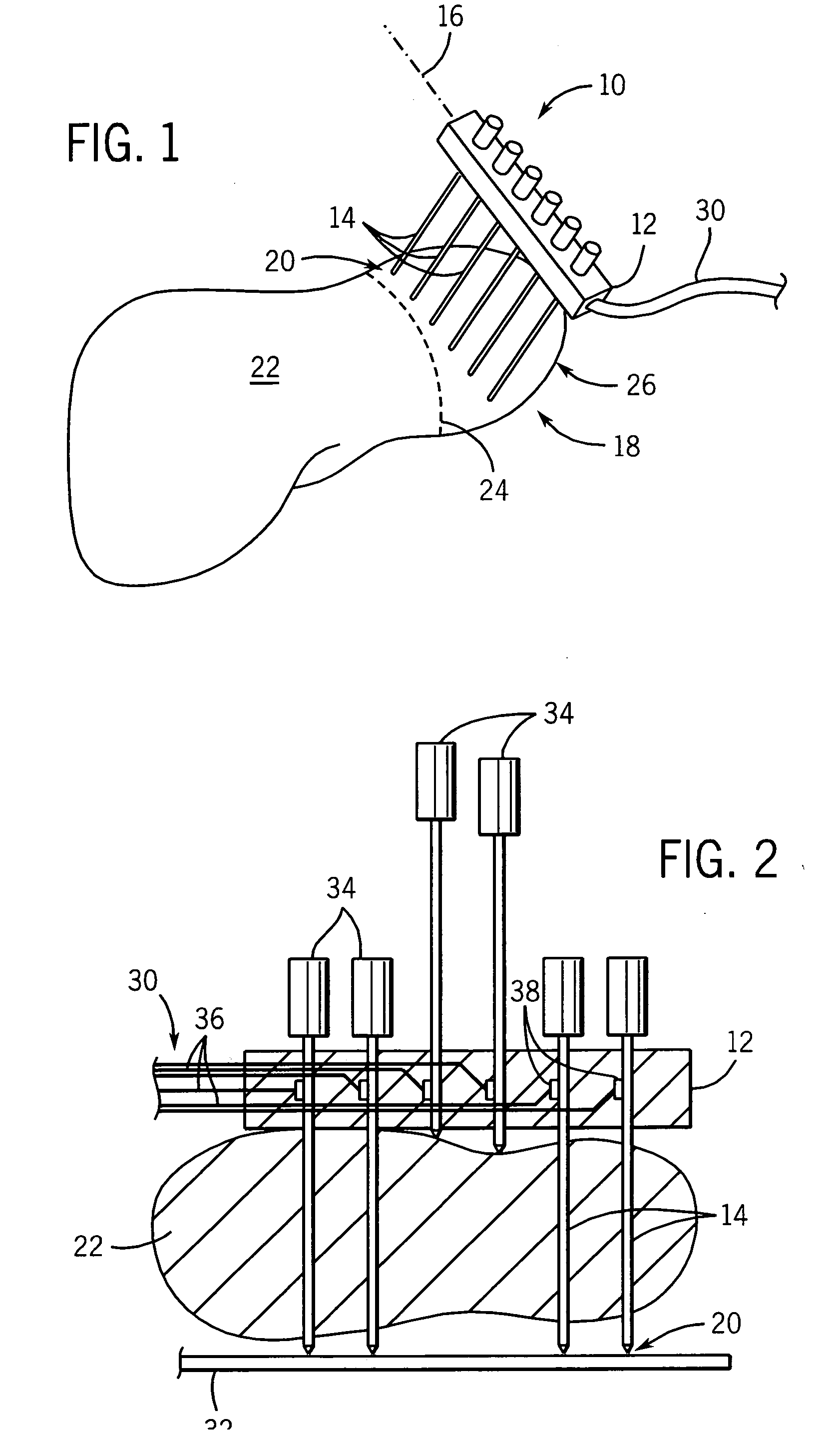 Electrode array for tissue ablation