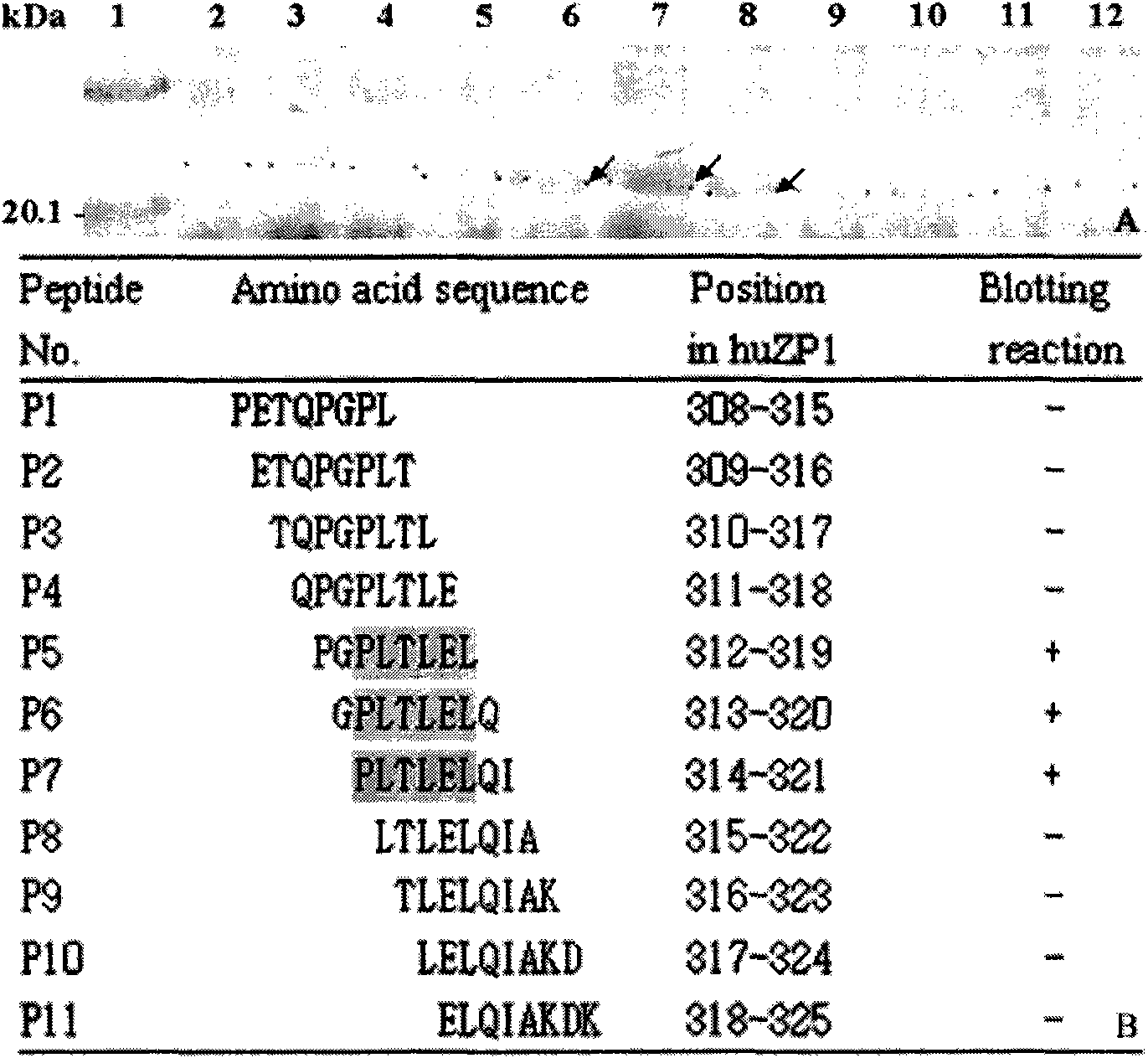 Epitope minimum motif peptide of human zona pellucida protein