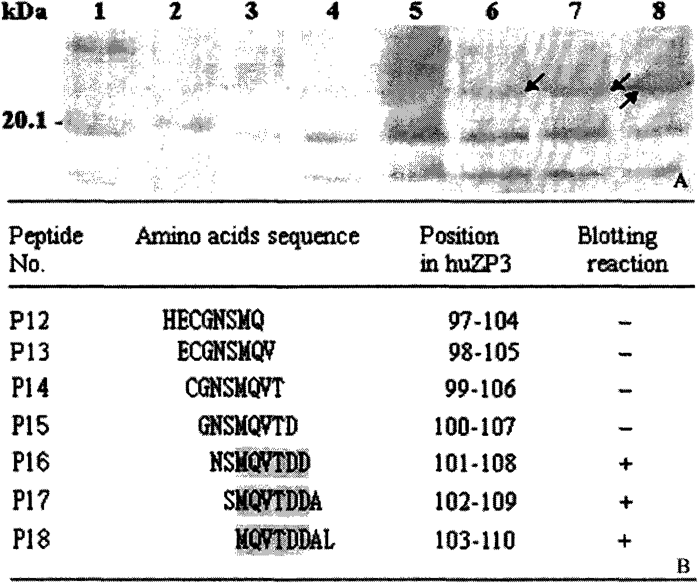 Epitope minimum motif peptide of human zona pellucida protein