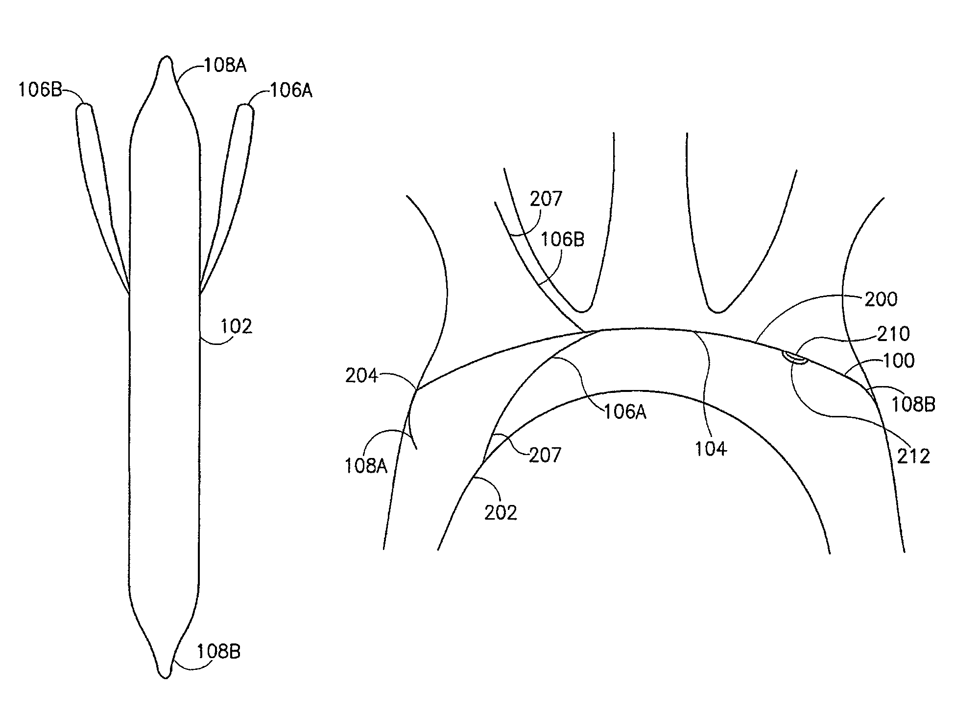 Device and method for vascular filter