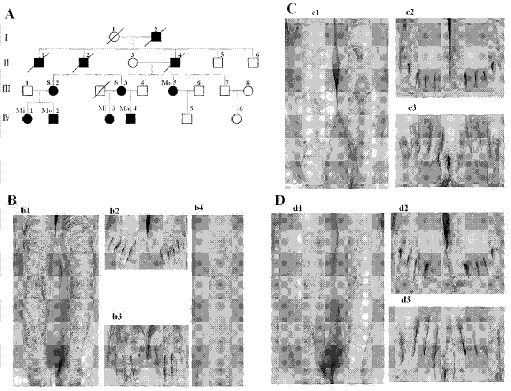 New mutation of PEB (Phosphatidylethanolamine Binding Protein) virulence gene and application thereof