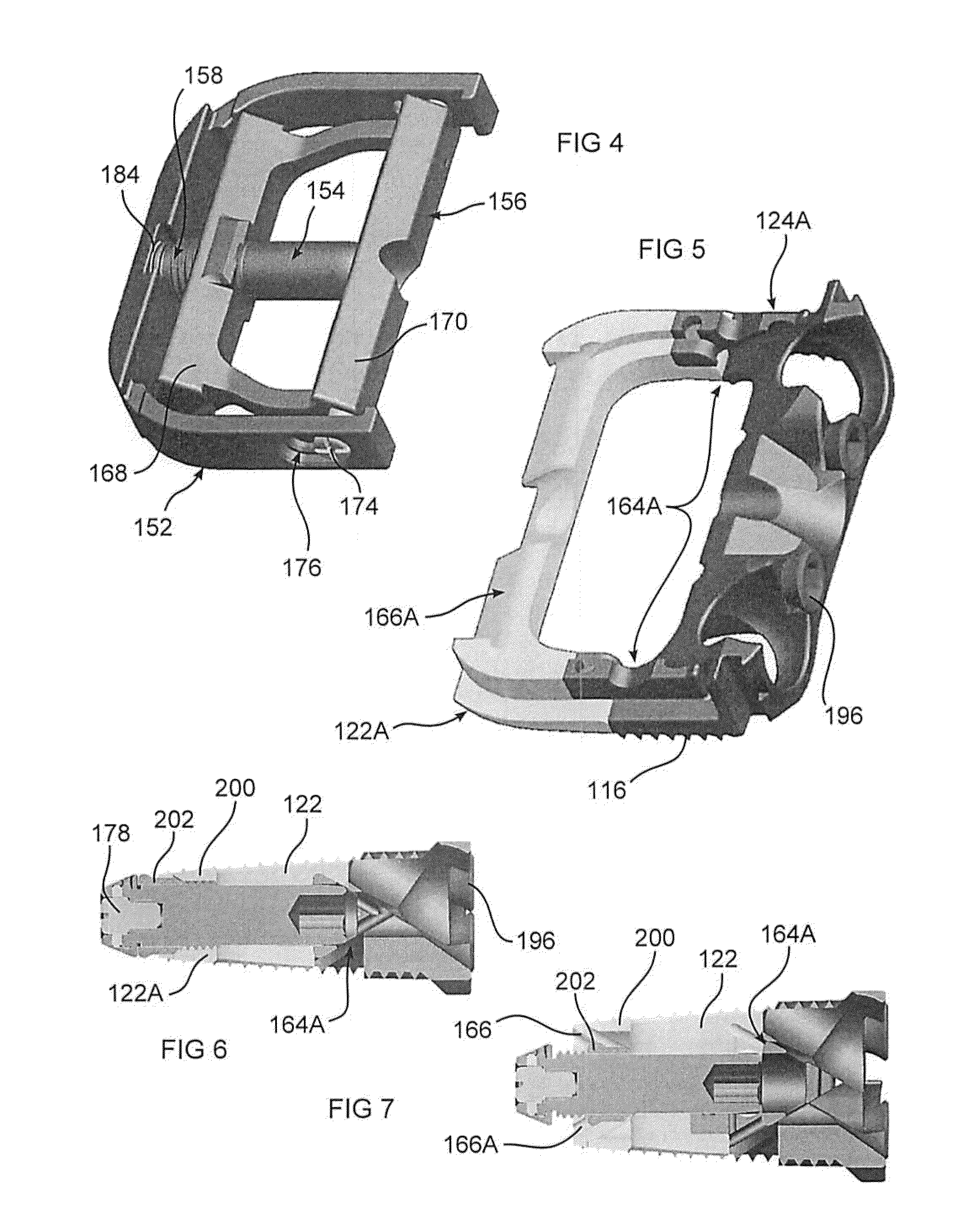 Expandable Intervertebral Implant