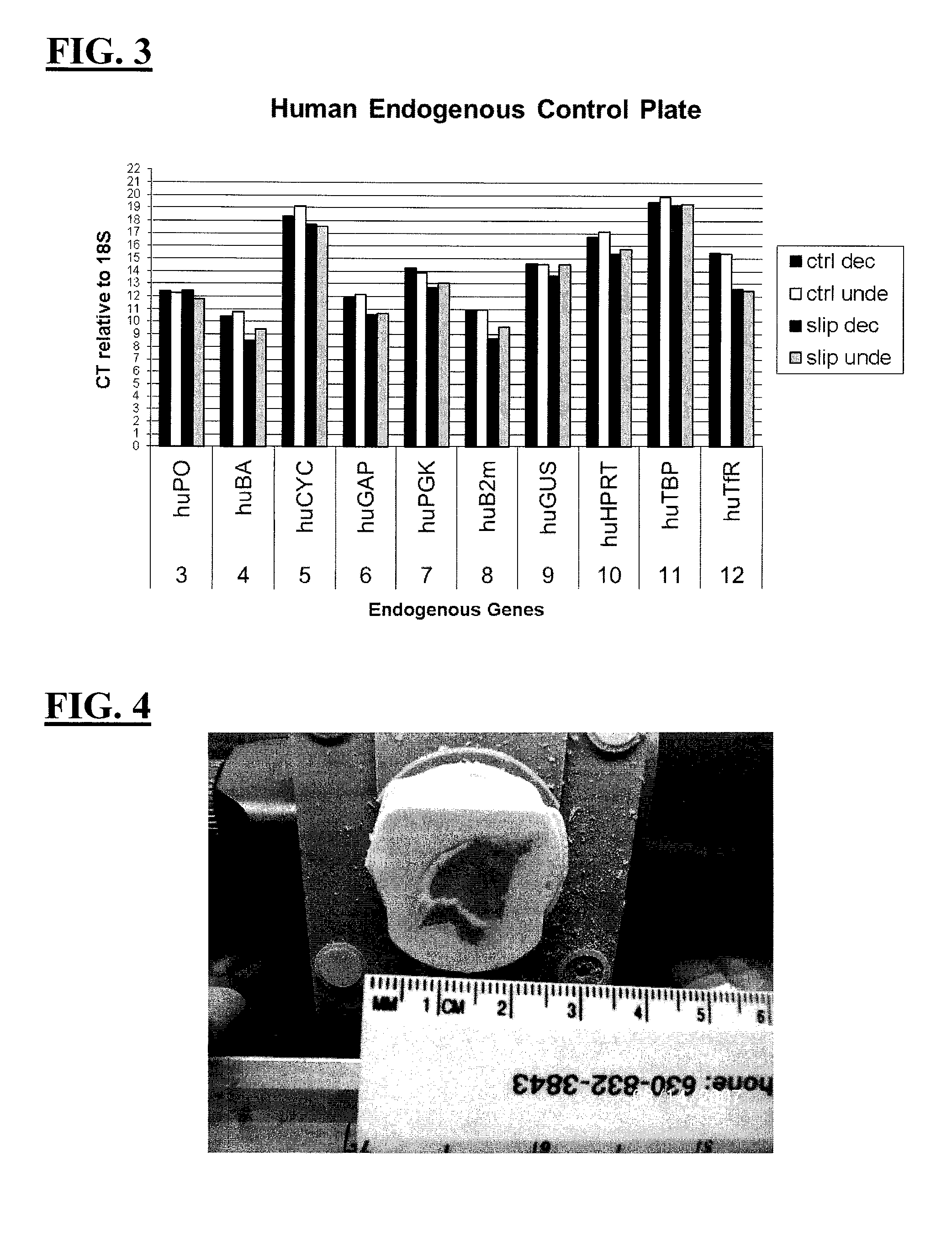 Decalcification Solution with Preservation of RNA