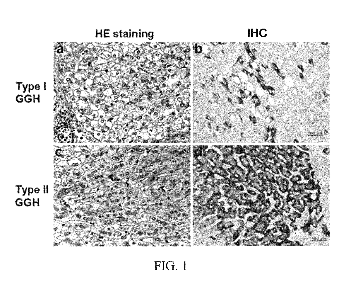 Antibodies and method for determining deletions in HBV pre-S<sub>2 </sub> region