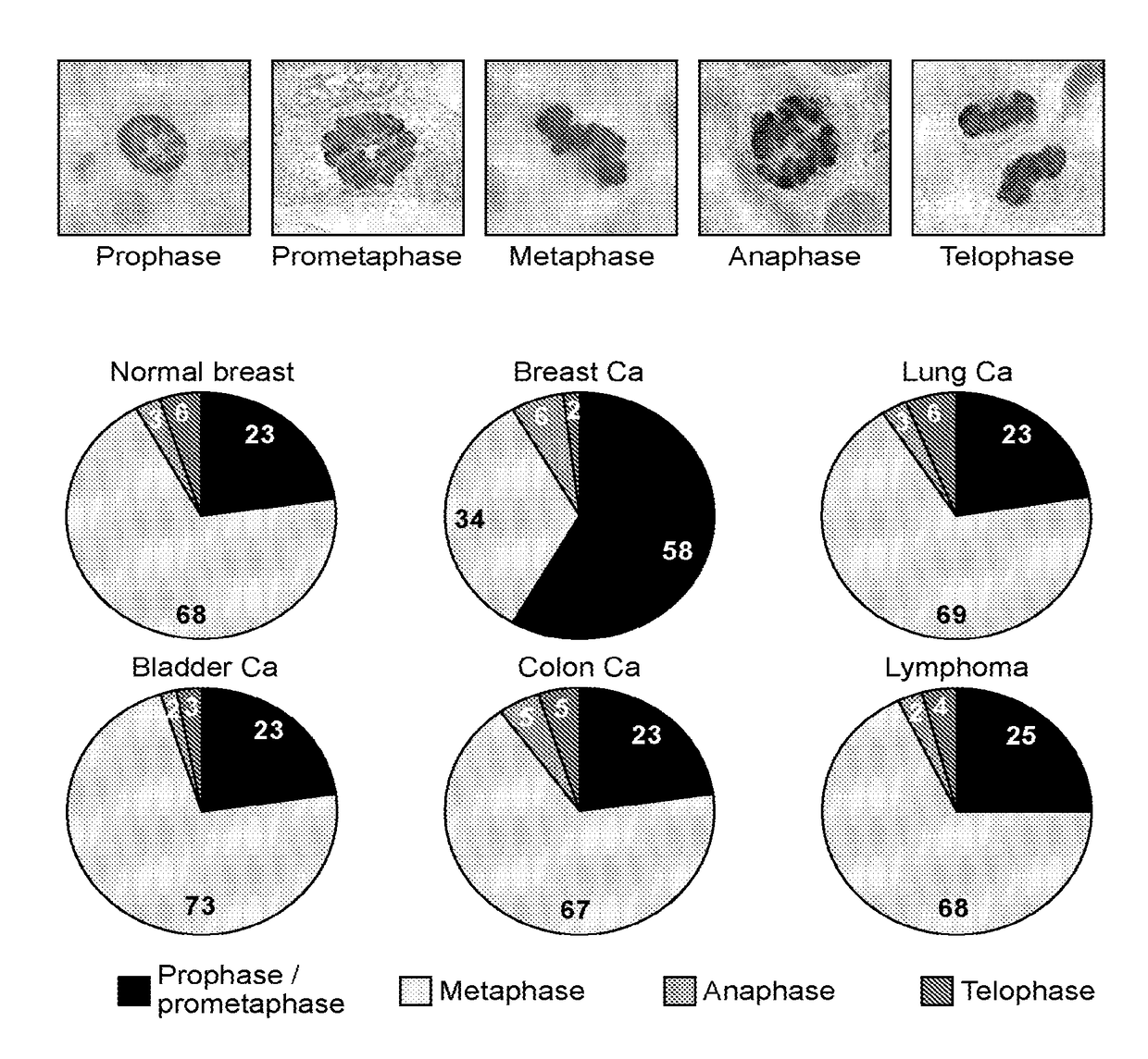 Detection and treatment of breast cancer