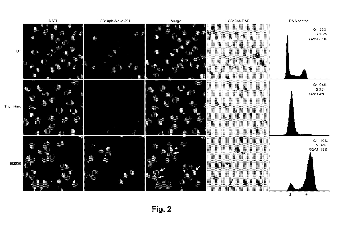 Detection and treatment of breast cancer