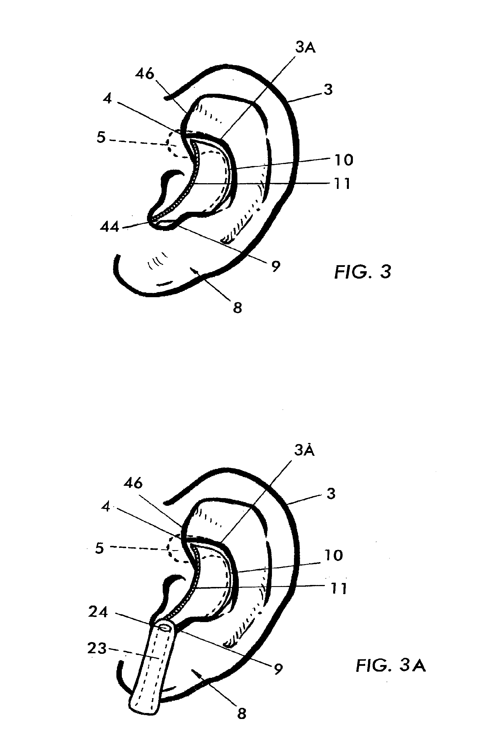 External ear insert for hearing comprehension enhancement