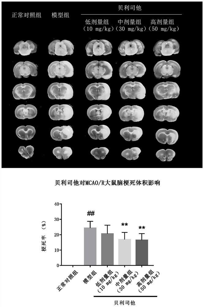 Application of belinostat in preparation of medicine for relieving and/or treating cerebral arterial thrombosis