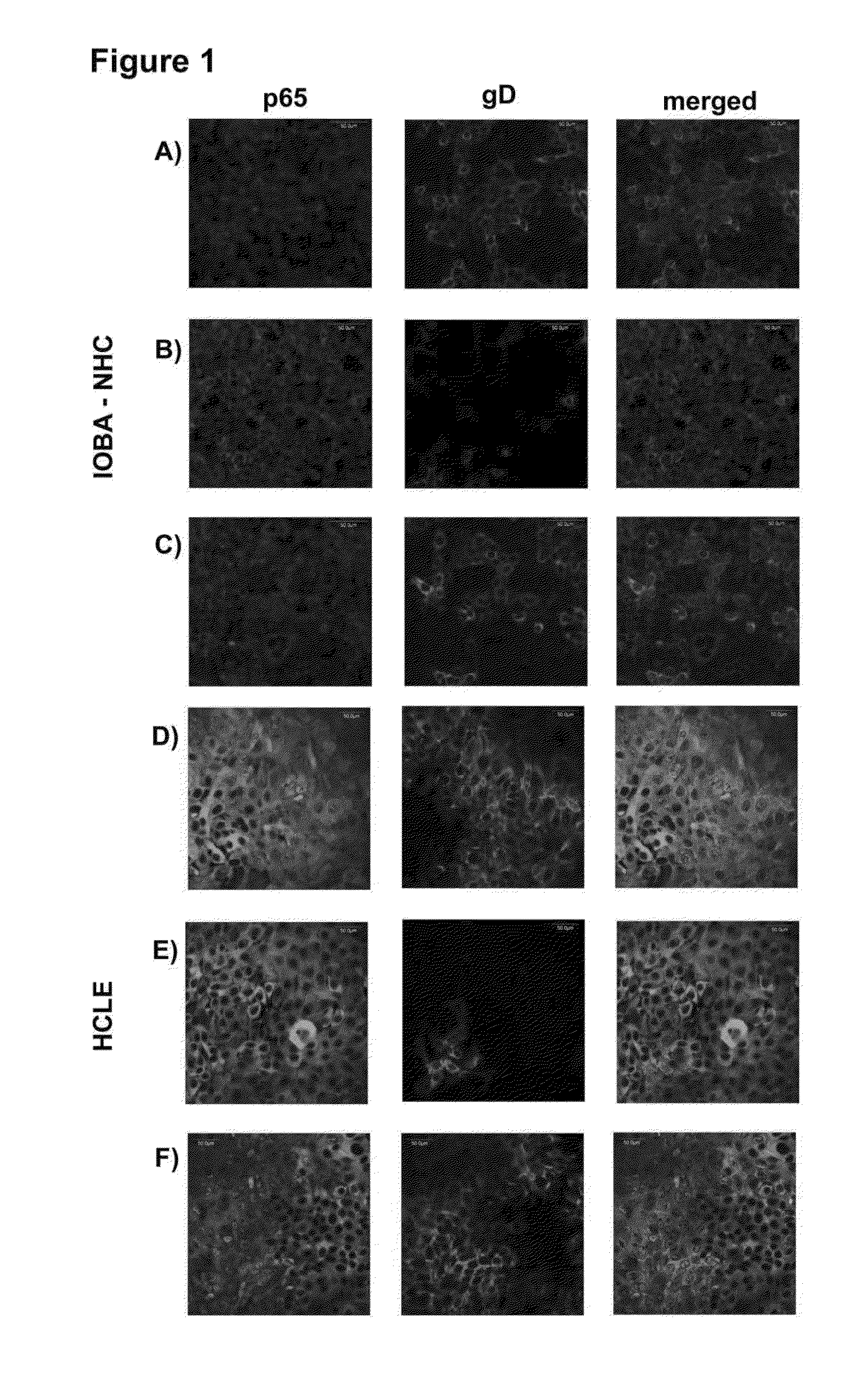 Antiangiogenic brassinosteroid compounds