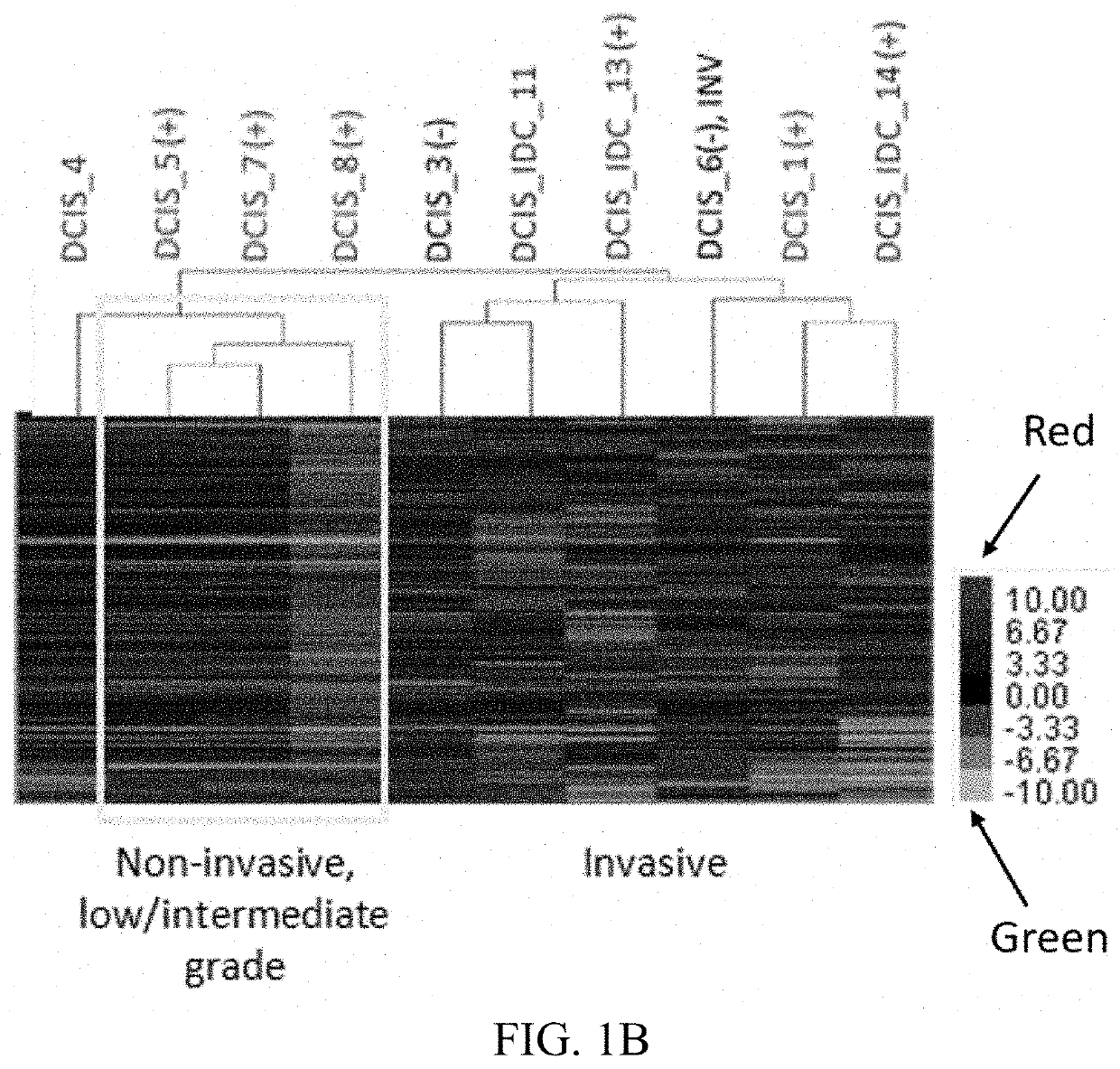 DNA methylation diagnostic test for breast cancer