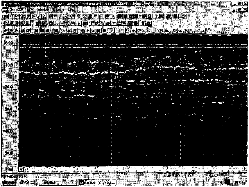 Safety state fast non-destructive detection method of operation roadbed