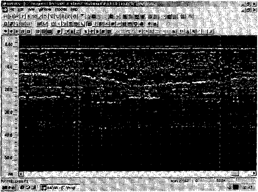 Safety state fast non-destructive detection method of operation roadbed