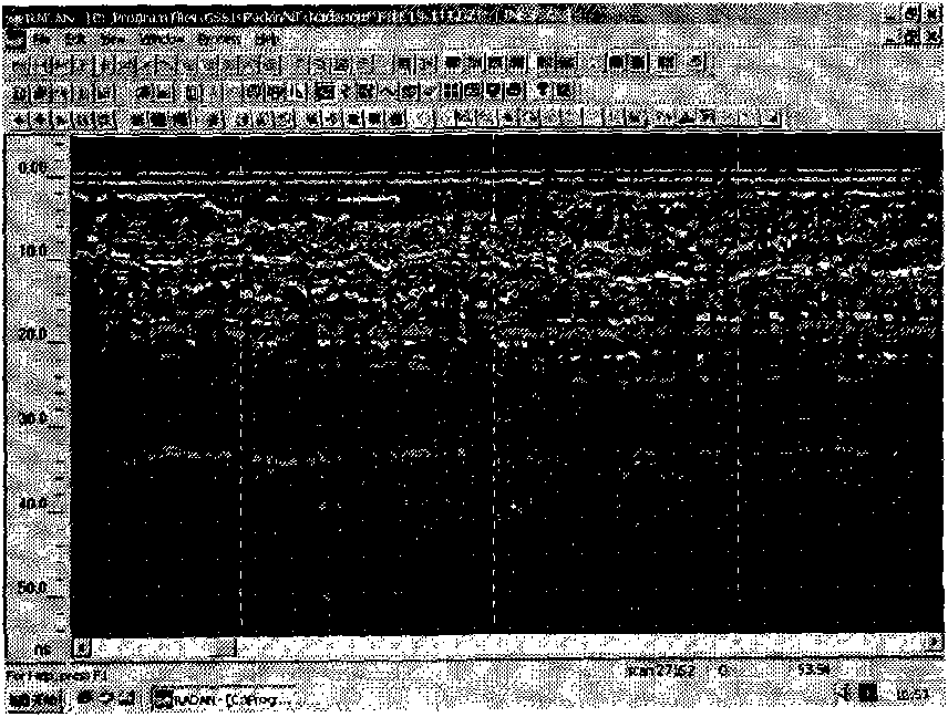 Safety state fast non-destructive detection method of operation roadbed