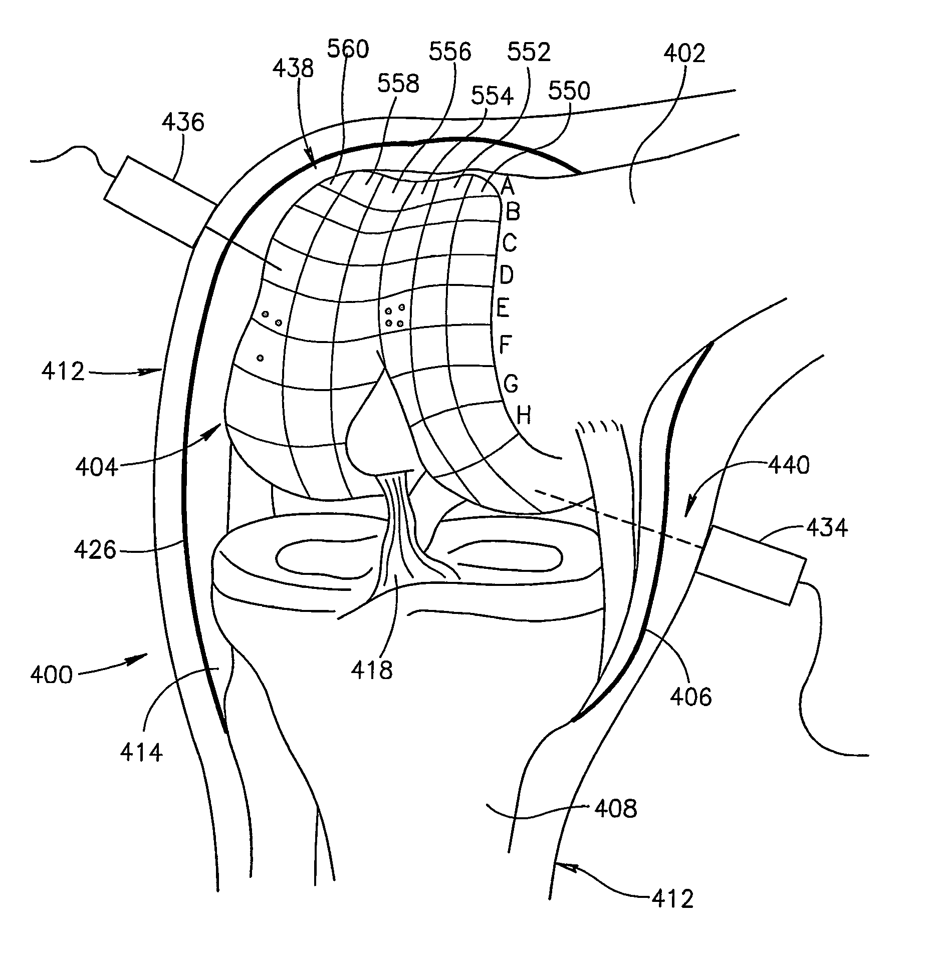 Joint analysis using ultrasound