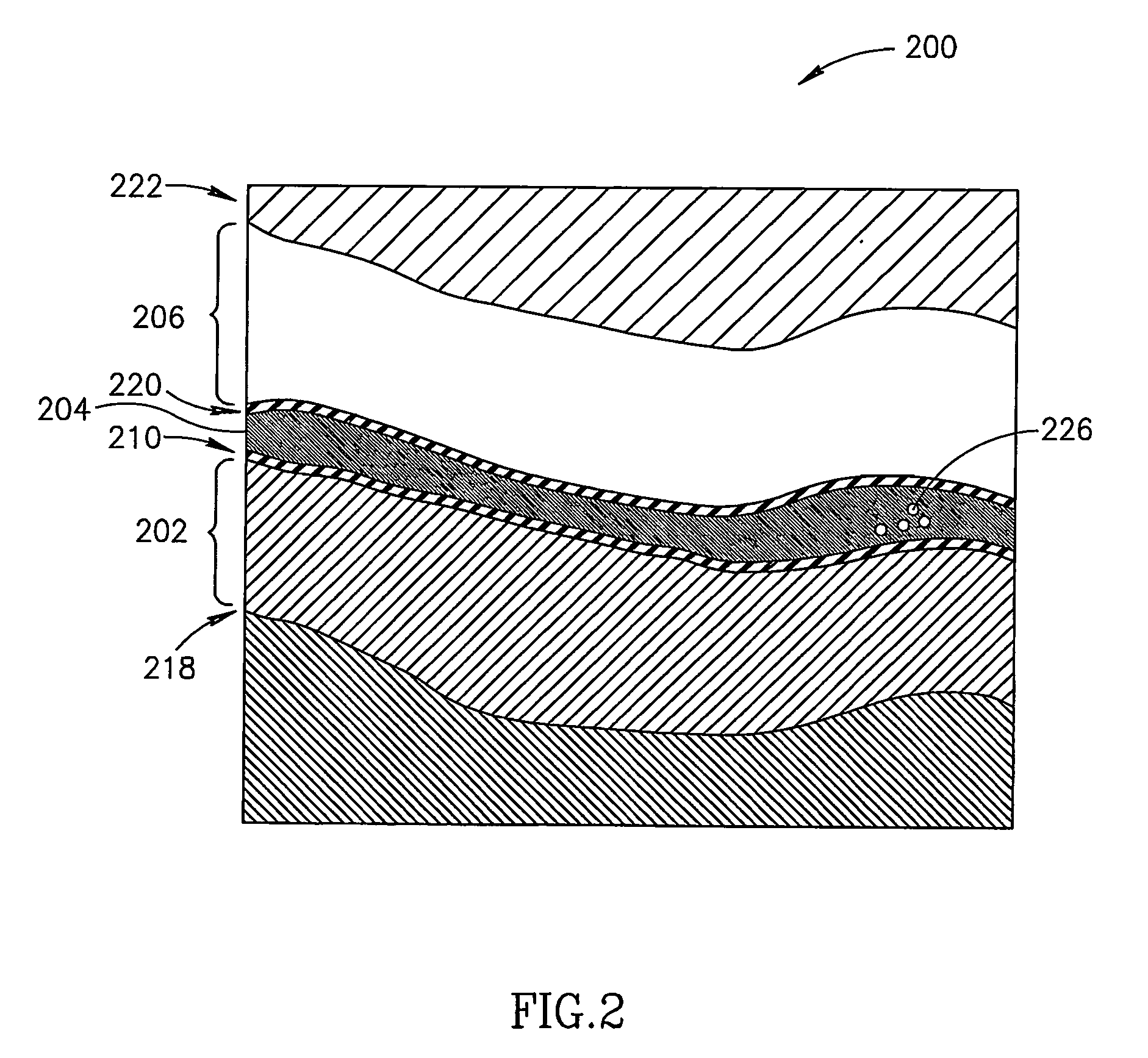 Joint analysis using ultrasound