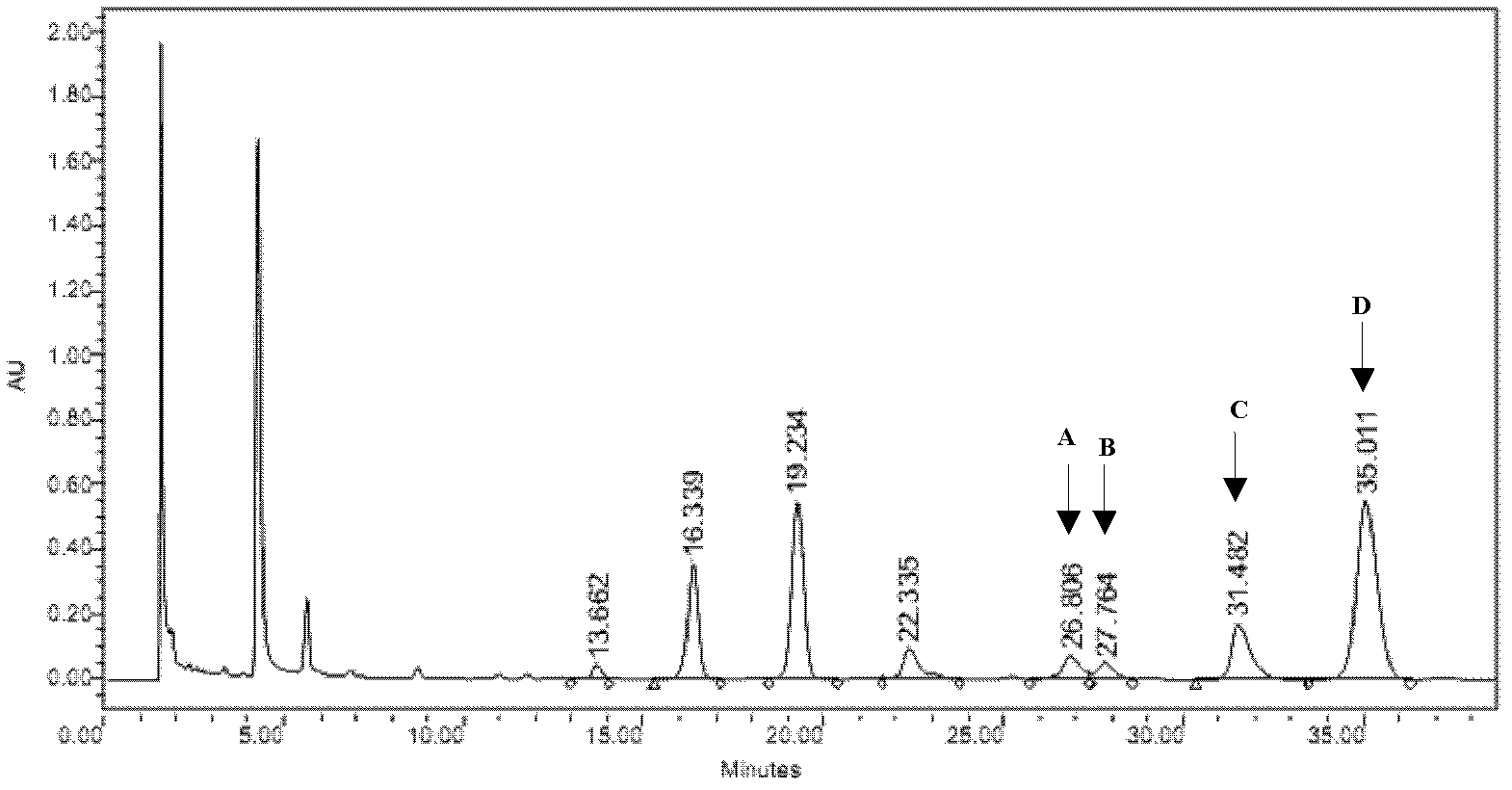 Method for simultaneously determining phytosterol and squalene in vegetable oil