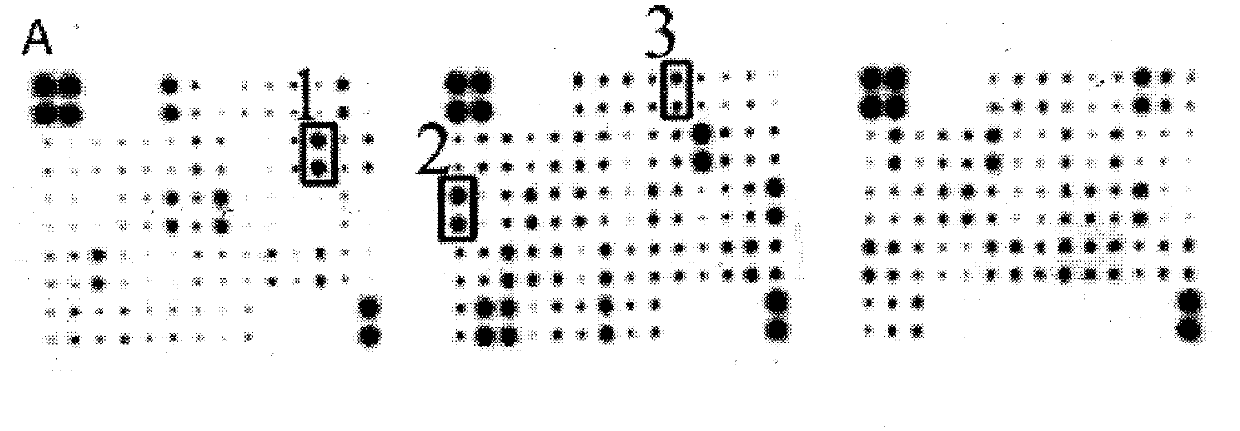 Making method of immunochromatographic test paper for detecting premature rupture of fetal membranes