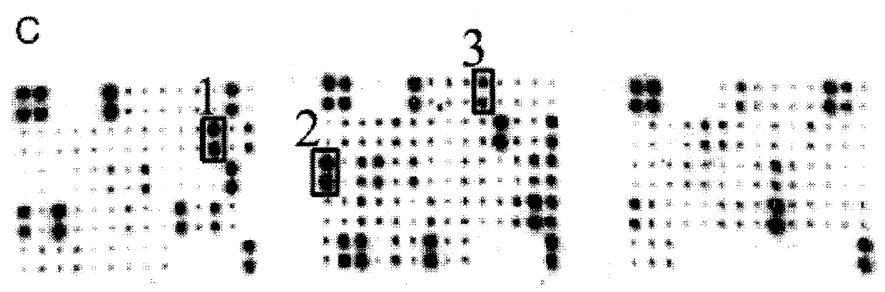 Making method of immunochromatographic test paper for detecting premature rupture of fetal membranes